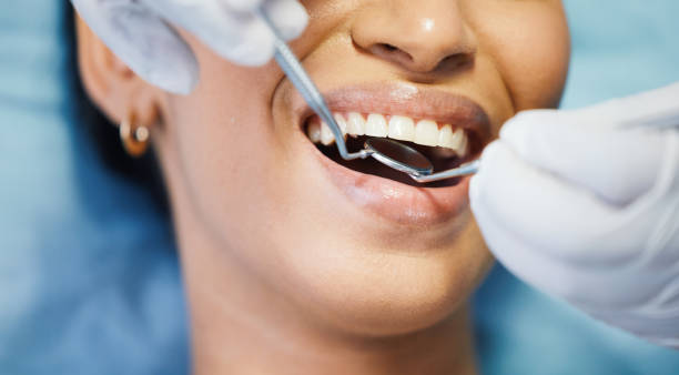 Best Emergency Dental Filling Replacement  in Oregon, IL