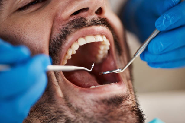 Best Emergency Gum Pain Relief  in Oregon, IL